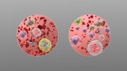 3D Medical Animation still showing comparison between Normal blood (L) and Leukemia (R)