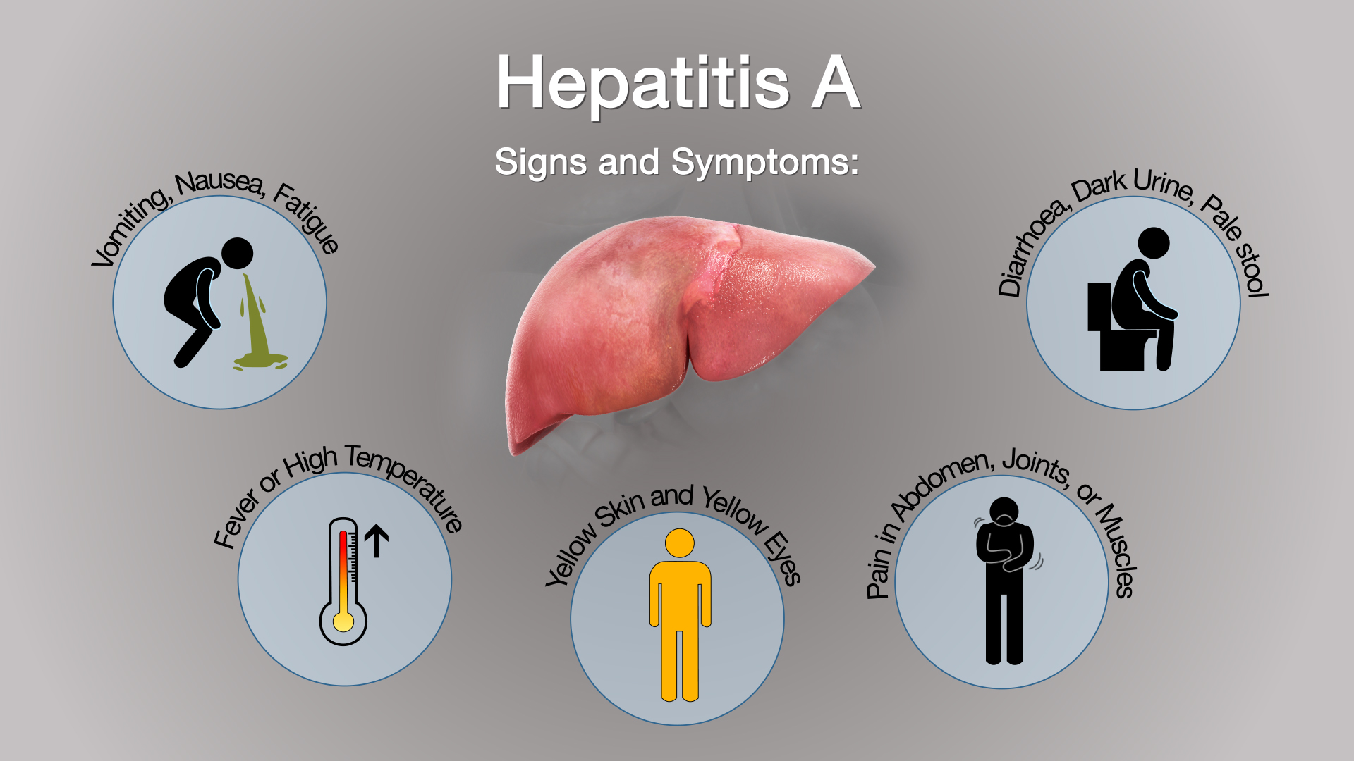 Hepatitis A BethaneyCoy