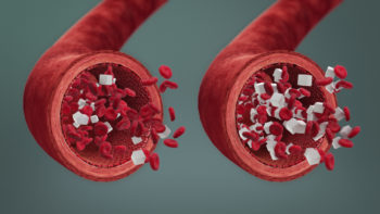 3D medical animation still showing difference between Normal and High Blood Glucose