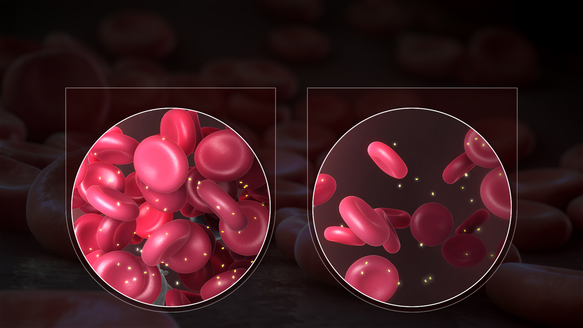 Different Types Of Anemia And What Causes Them