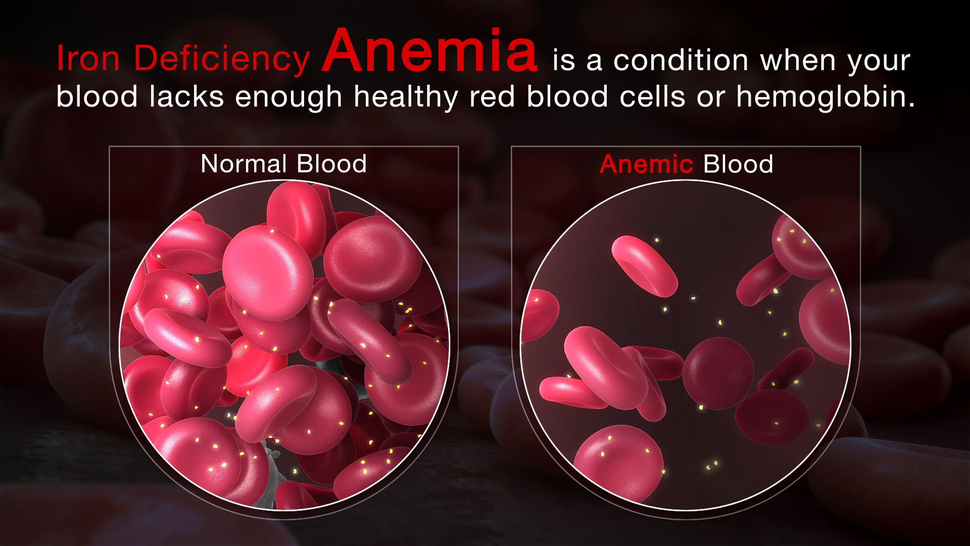 Comparison between Normal Blood and Anemic Blood