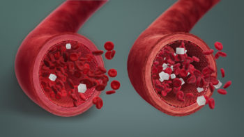 3D Medical animation still showing Blood sugar level