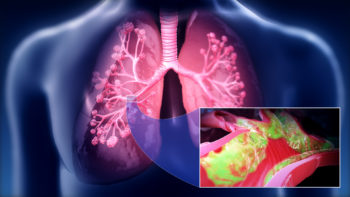 Medical animation still showing Respiratory tract