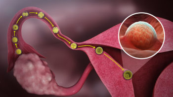 Medical animation still showing passage of oocyte from ovary to the uterus.
