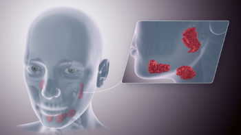 Medical animation still showing salivary glands.