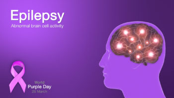 3D Medical Animation Still Depicting Epilepsy
