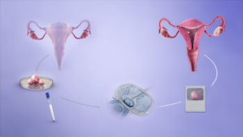 3D medical animation still depicting invitro fertilization