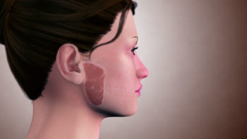 3D medical animation still showing parotid gland
