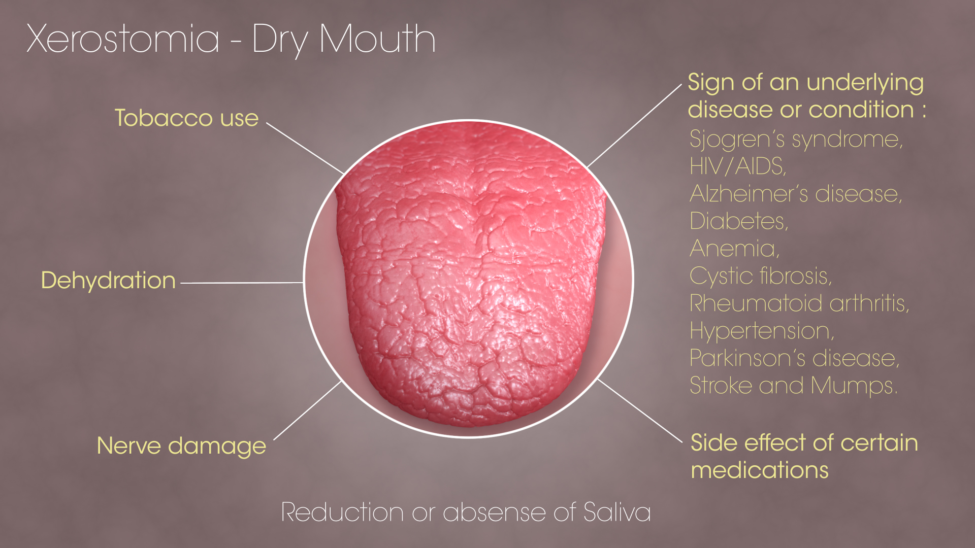 6 Causes Of Sticky Saliva & Home Remedies