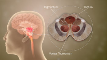 3D Medical Animation Still Shot Showing Different Parts of Mid-Brain