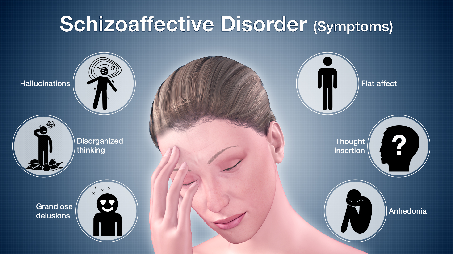 Schizoaffective Disorder Shown Using 3d Medical Animation
