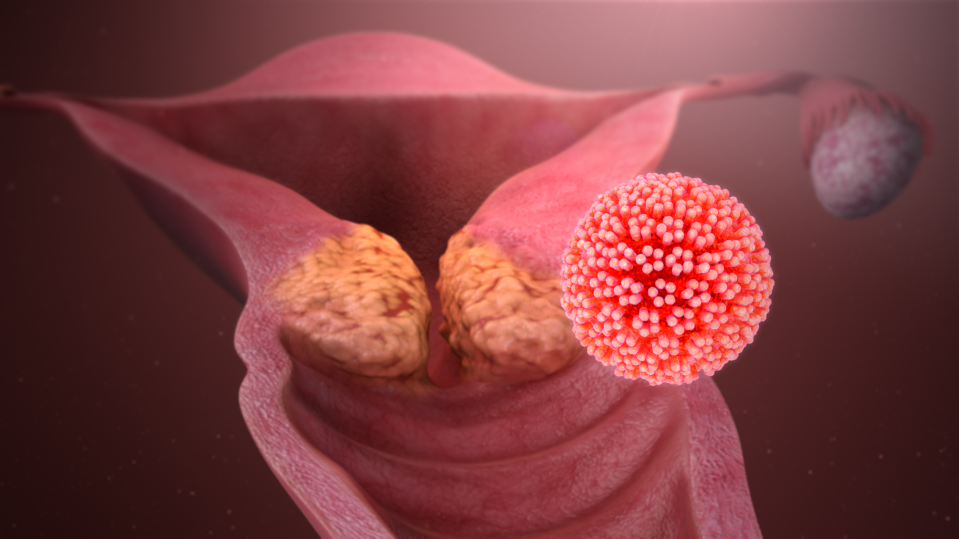 3D Medical Animation still shot showing Cervical Cancer