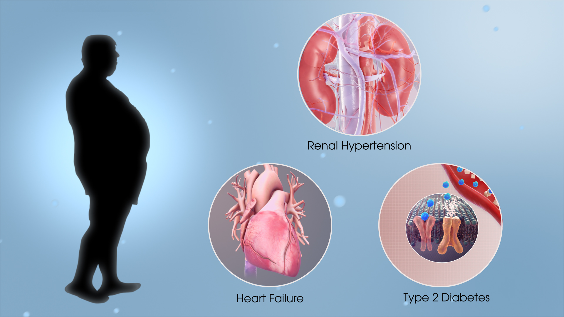 3D medical animation still shot showing metabolic syndrome