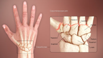 3D Medical Animation Human Wrist