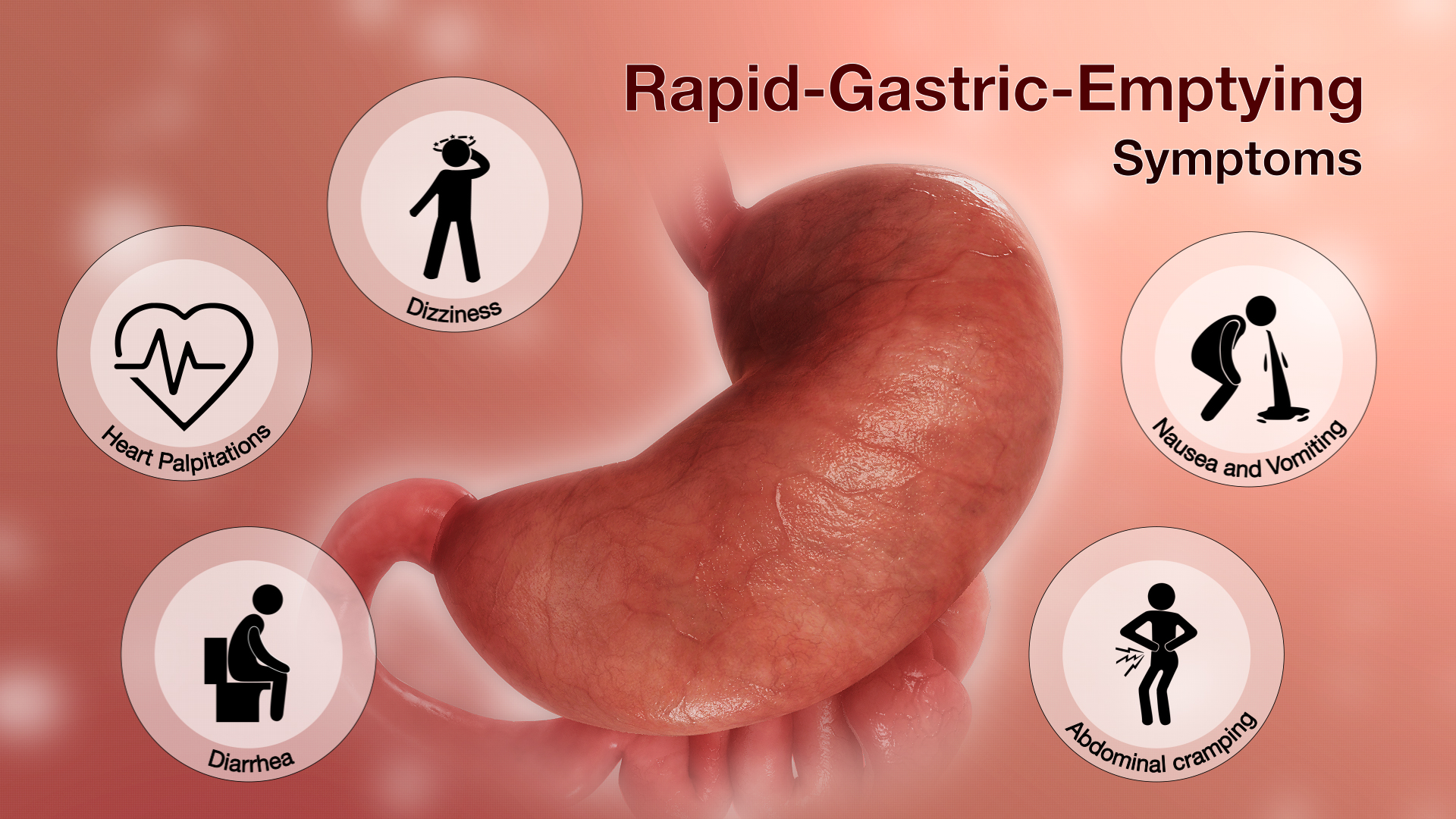 Gastric
