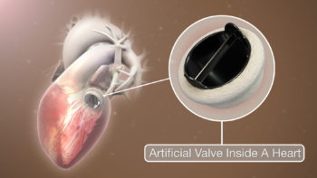 3D Medical Animation still shot Artificial Heart Valve