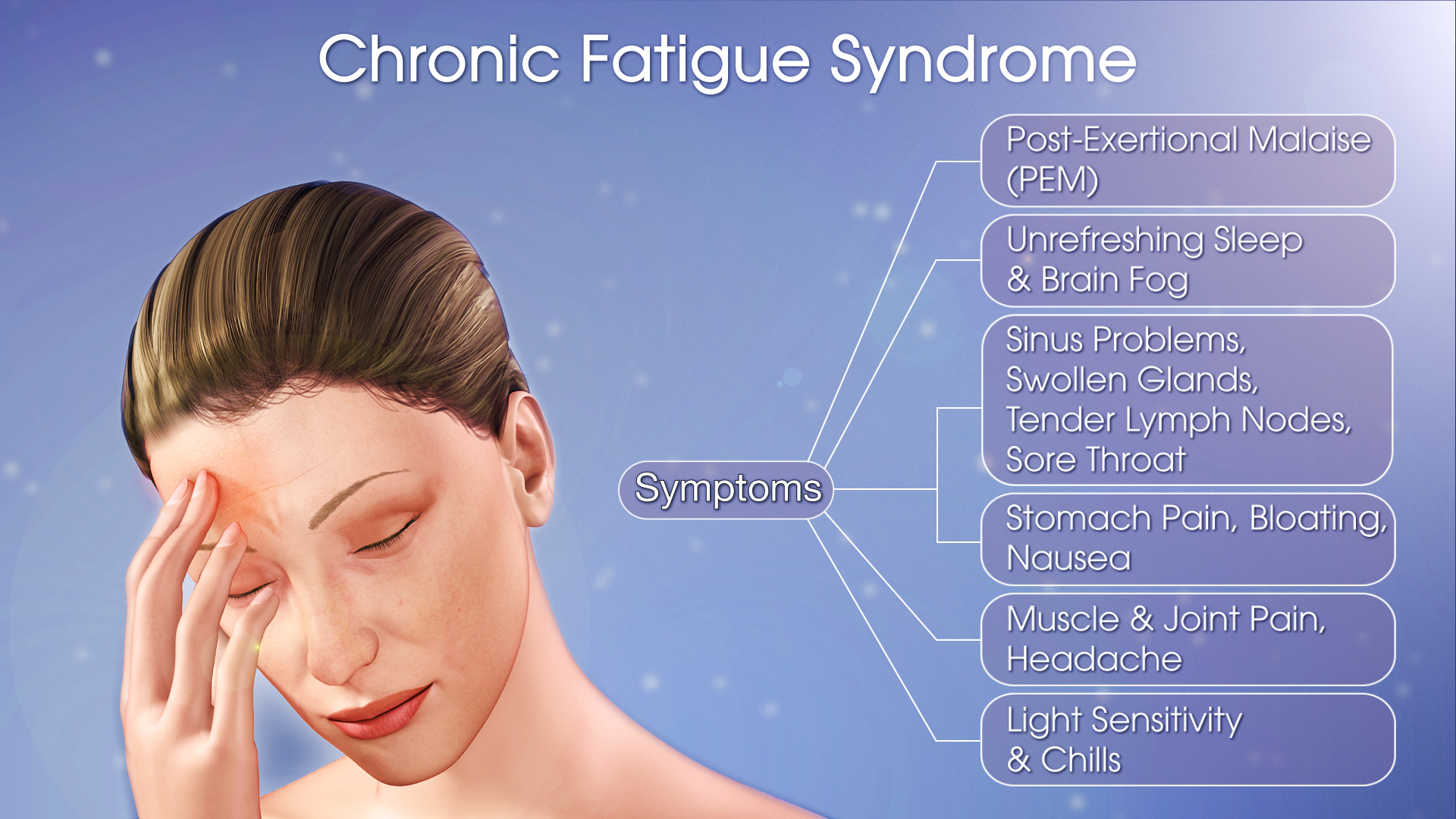 Medical Animation Showing Symptoms Of Chronic Fatigue Syndrome