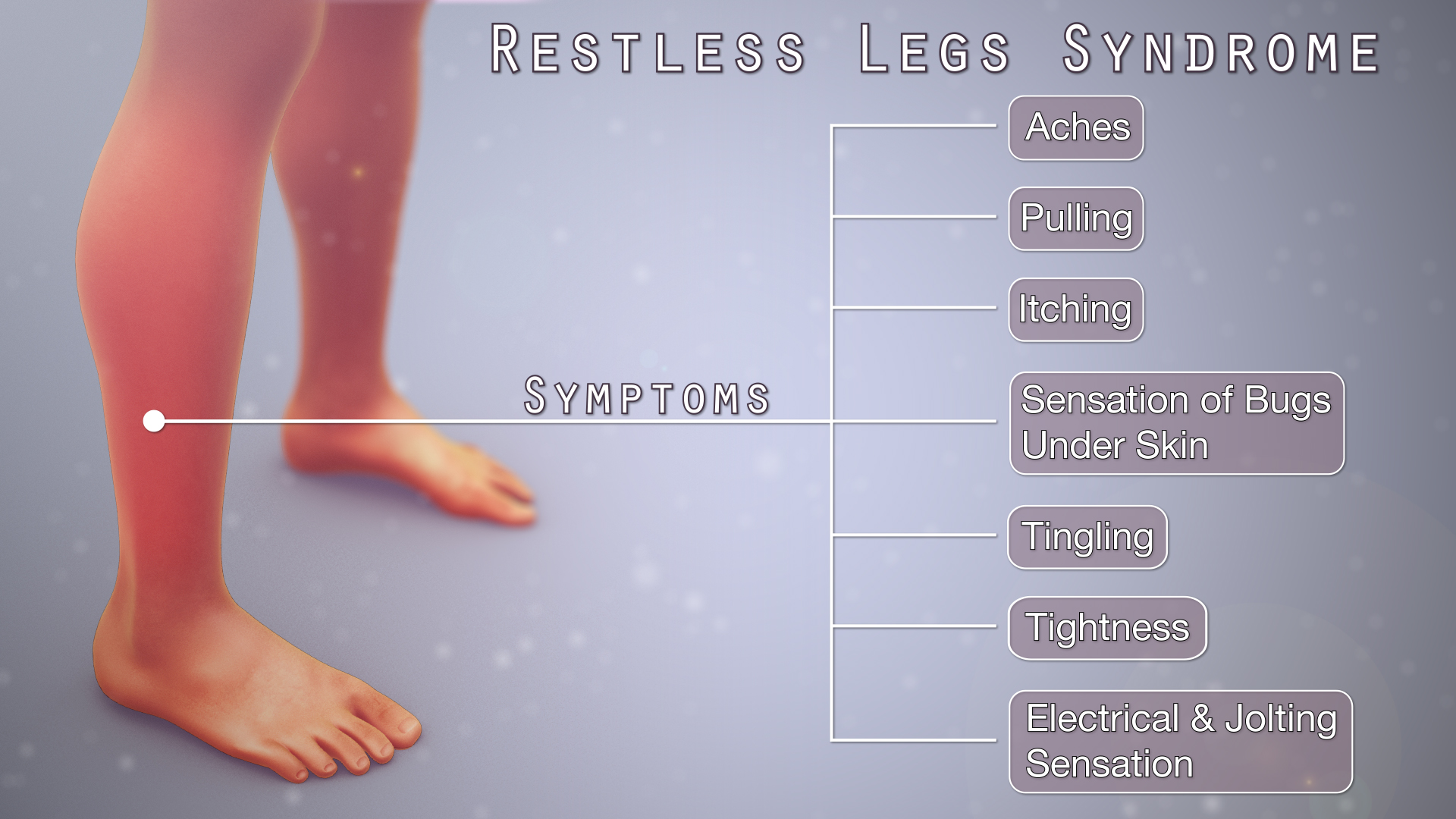 Restless Legs Syndrome Shown & Explained Using A Medical  
