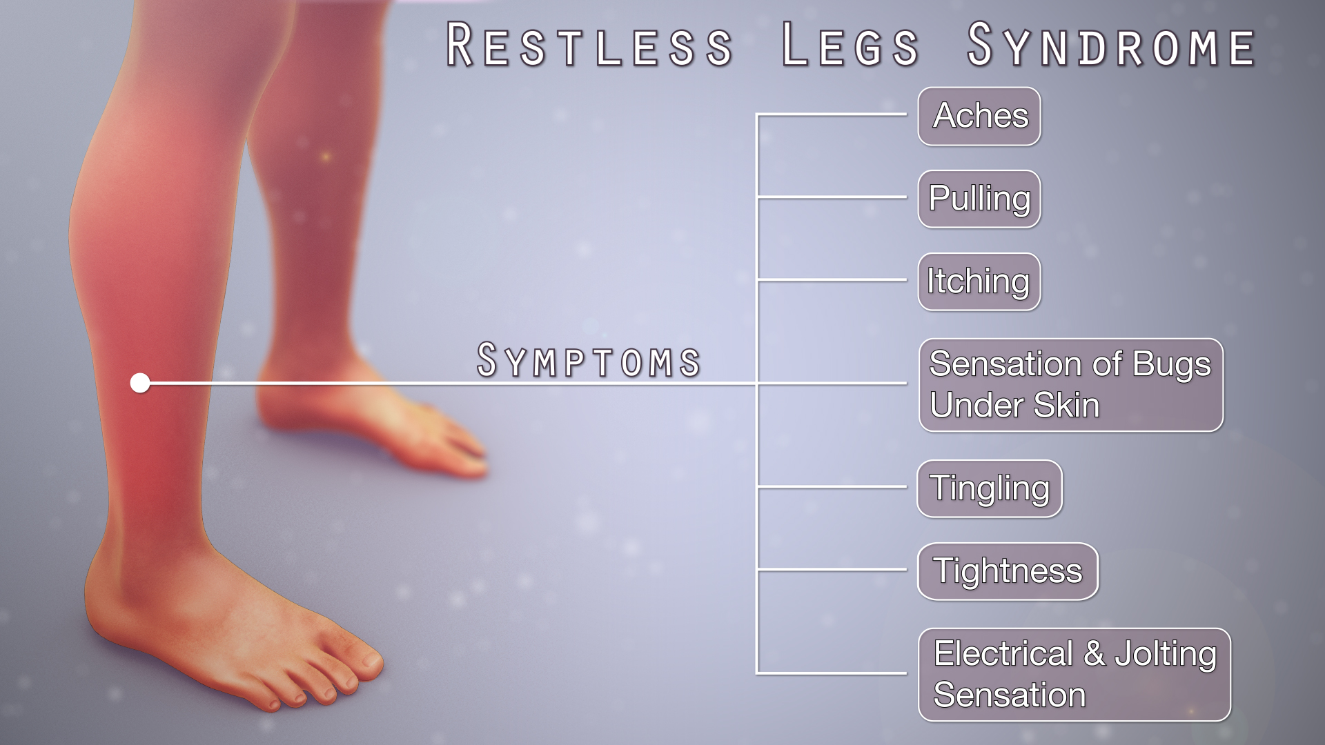 Medical Animation Showing Symptoms Of Restless Legs Syndrome