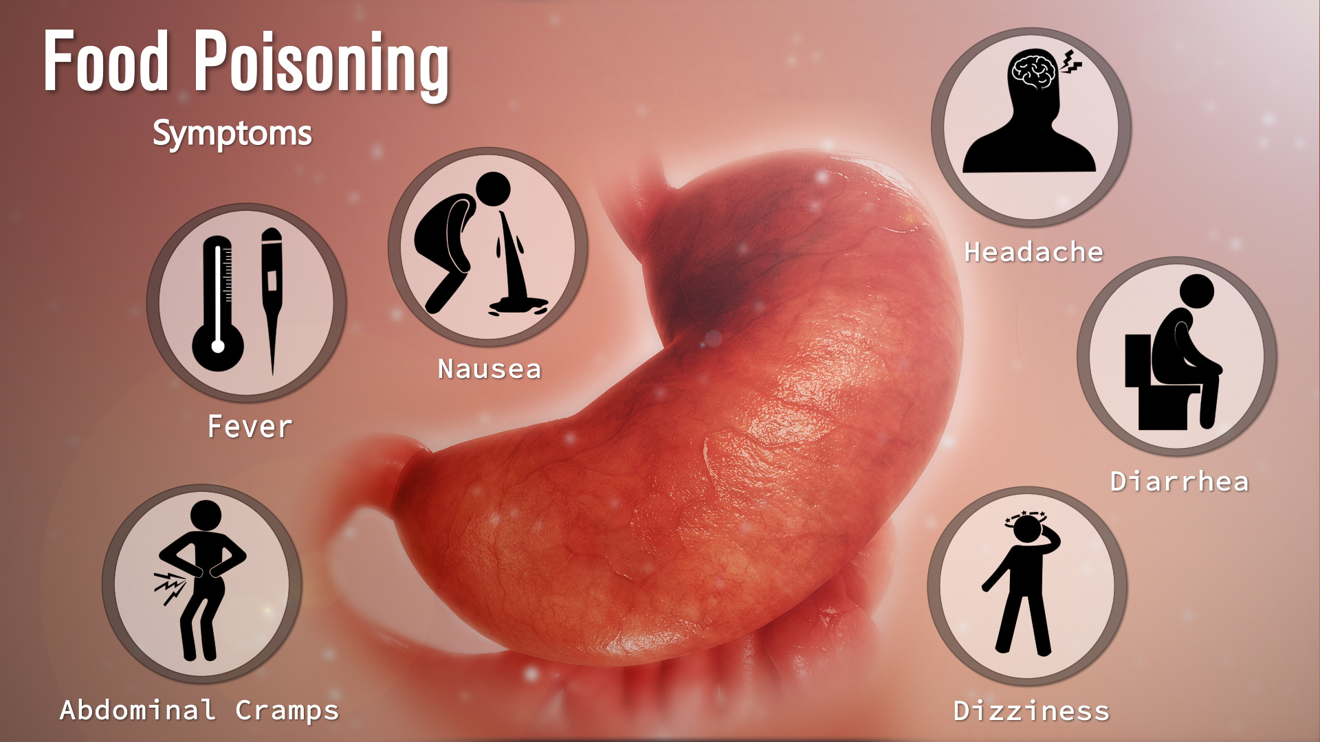 Medical Animation Showing Symptoms Of Food Poisoning
